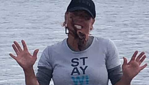 Woman Hospitalized After the Octopus She Put on Her Face for a Photo Contest Injected Her With Venom